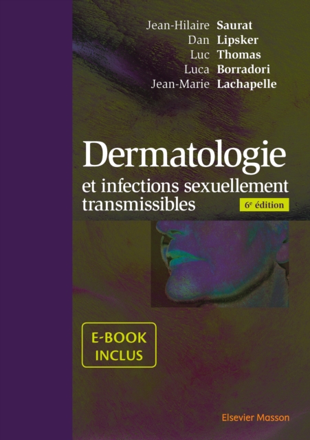 Dermatologie et infections sexuellement transmissibles : Avec ebook, PDF eBook