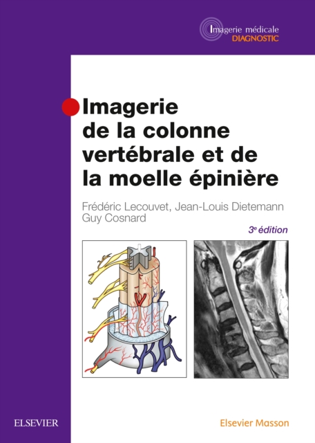 Imagerie de la colonne vertebrale et de la moelle epiniere, PDF eBook