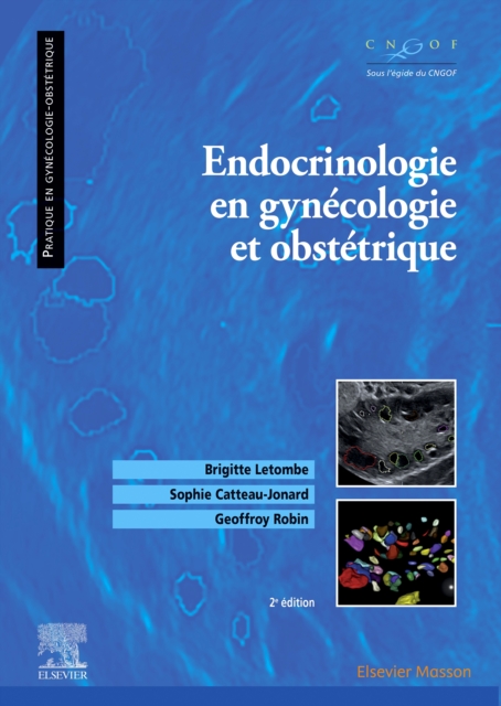 Endocrinologie en gynecologie et obstetrique, EPUB eBook