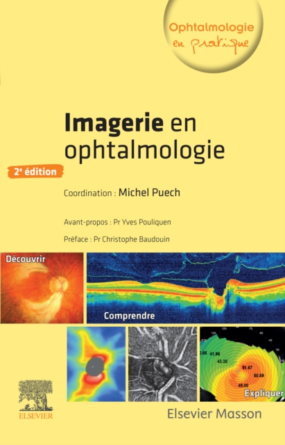 Imagerie en ophtalmologie, EPUB eBook