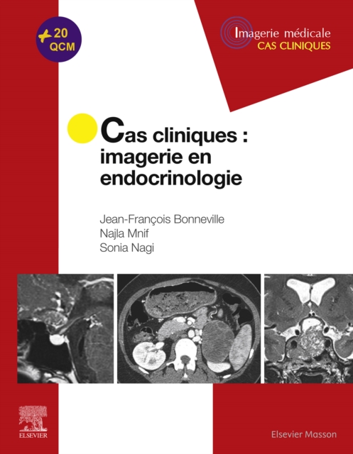 Cas cliniques en imagerie : endocrinologie, EPUB eBook