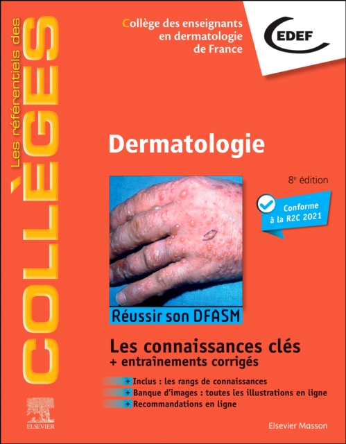 Dermatologie : Reussir son DFASM - Connaissances cles, PDF eBook