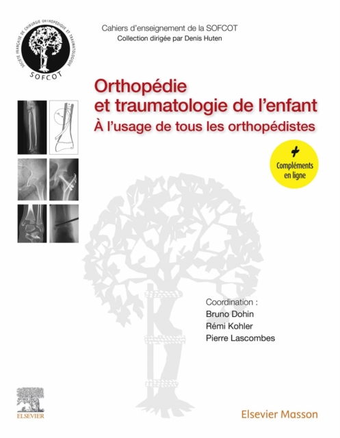 Orthopedie et traumatologie de l'enfant : A l'usage de tous les orthopedistes, EPUB eBook