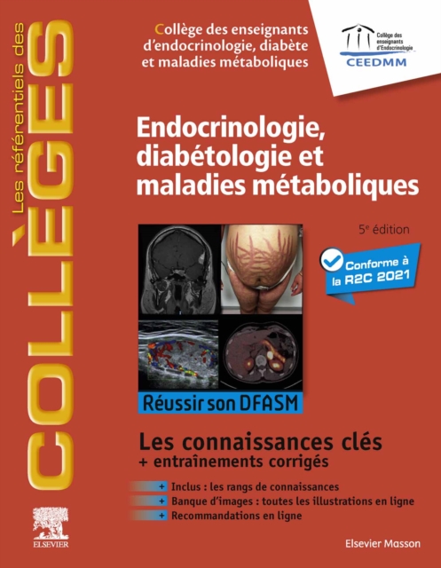 Endocrinologie, diabetologie et maladies metaboliques : Reussir son DFASM - Connaissances cles, EPUB eBook