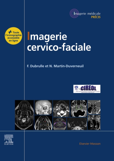Imagerie cervicofaciale : Massif facial - Sinus - Voies aerodigestives superieures - Pathologies cervicales - Espaces profonds de la face, EPUB eBook