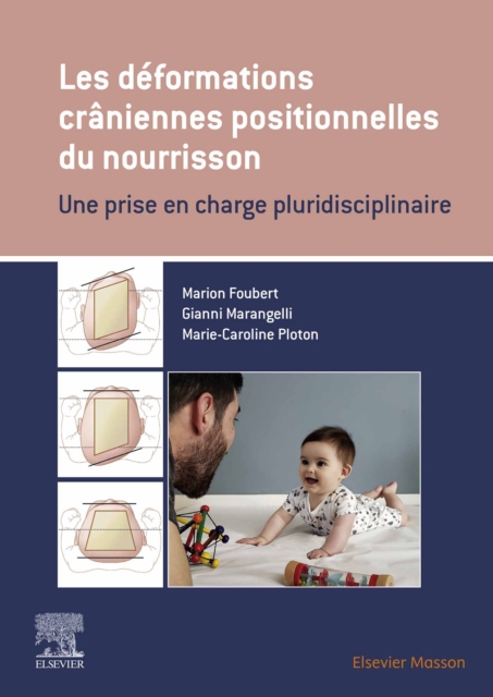 Les deformations craniennes positionnelles du nourrisson : Une prise en charge pluridisciplinaire, EPUB eBook