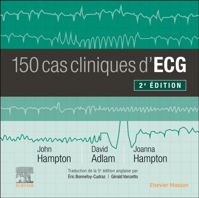150 cas cliniques d'ECG, EPUB eBook