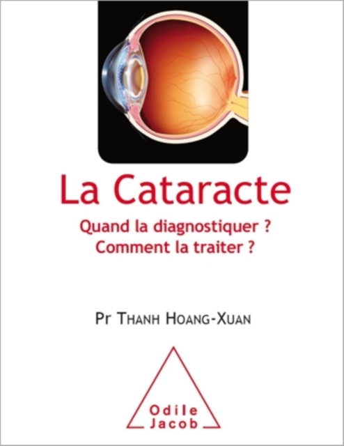 La Cataracte : Quand la diagnostiquer ? Comment la traiter ?, EPUB eBook
