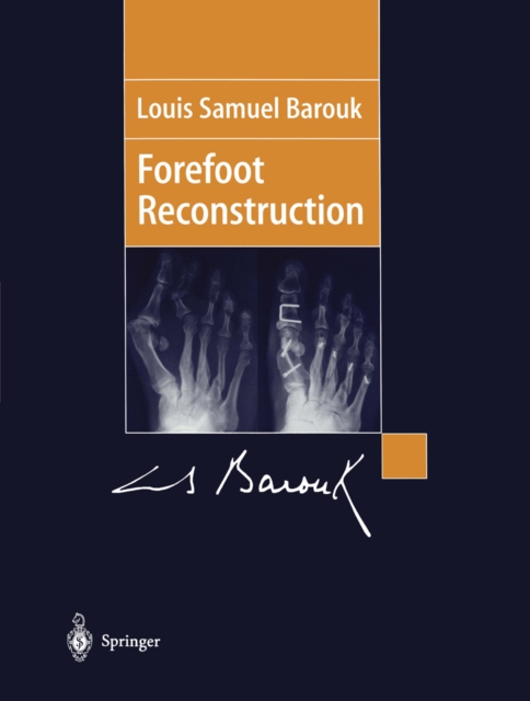 Forefoot Reconstruction, PDF eBook