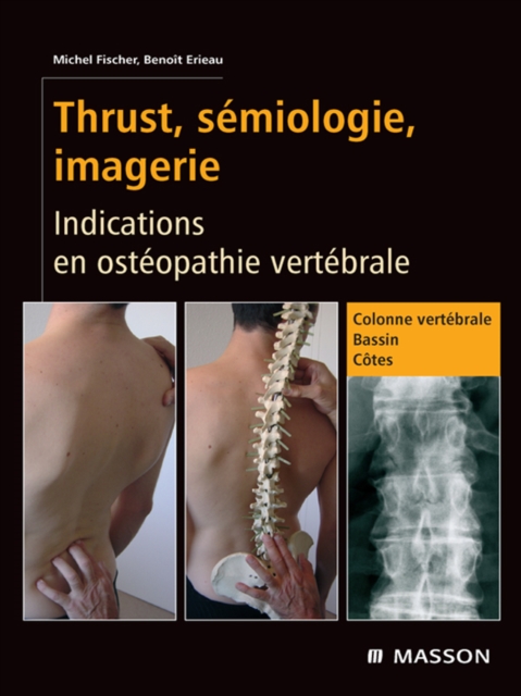 Thrust, semiologie, imagerie : Indications en osteopathie vertebrale, EPUB eBook
