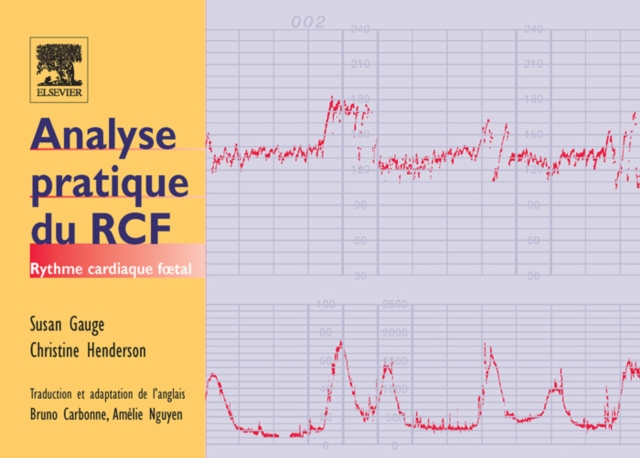Analyse pratique du RCF : Rythme cardiaque fœtal, EPUB eBook