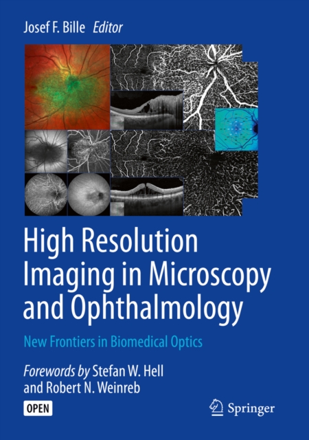High Resolution Imaging in Microscopy and Ophthalmology : New Frontiers in Biomedical Optics, EPUB eBook