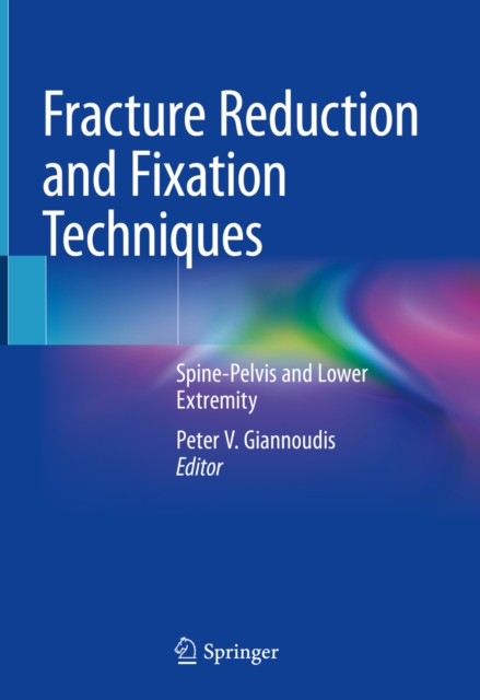 Fracture Reduction and Fixation Techniques : Spine-Pelvis and Lower Extremity, EPUB eBook