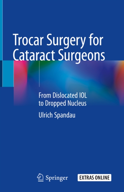 Trocar Surgery for Cataract Surgeons : From Dislocated IOL to Dropped Nucleus, EPUB eBook