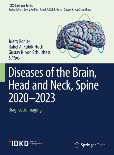 Diseases of the Brain, Head and Neck, Spine 2020-2023 : Diagnostic Imaging, EPUB eBook
