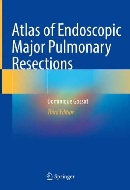 Atlas of Endoscopic Major Pulmonary Resections, EPUB eBook