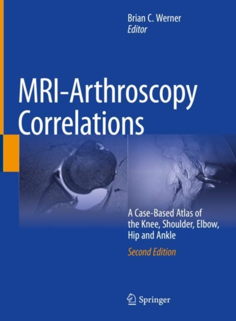 MRI-Arthroscopy Correlations : A Case-Based Atlas of the Knee, Shoulder, Elbow, Hip and Ankle, EPUB eBook