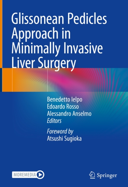 Glissonean Pedicles Approach in Minimally Invasive Liver Surgery, EPUB eBook