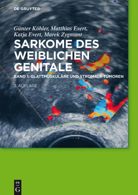 Glattmuskulare und stromale Tumoren, PDF eBook