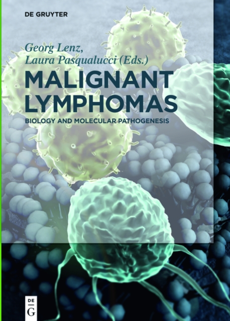 Malignant Lymphomas : Biology and Molecular Pathogenesis, PDF eBook