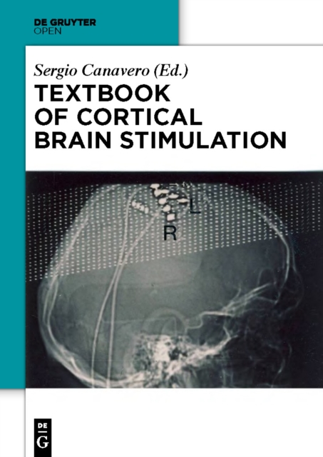 Textbook of Cortical Brain Stimulation, PDF eBook