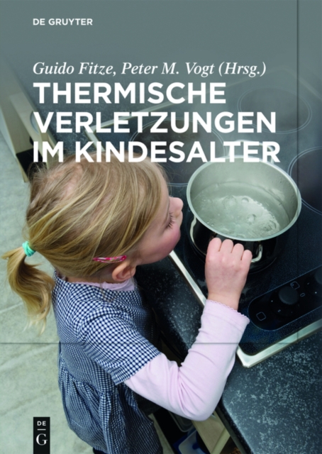 Thermische Verletzungen im Kindesalter, PDF eBook