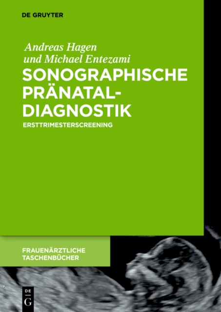 Sonographische Pranataldiagnostik : Ersttrimesterscreening, EPUB eBook