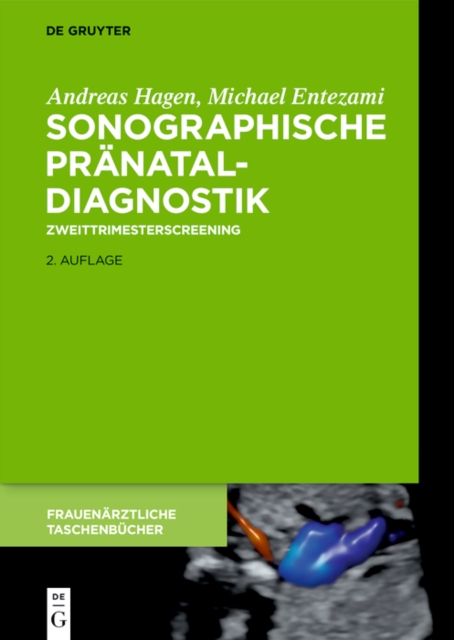 Sonographische Pranataldiagnostik : Zweittrimesterscreening, PDF eBook