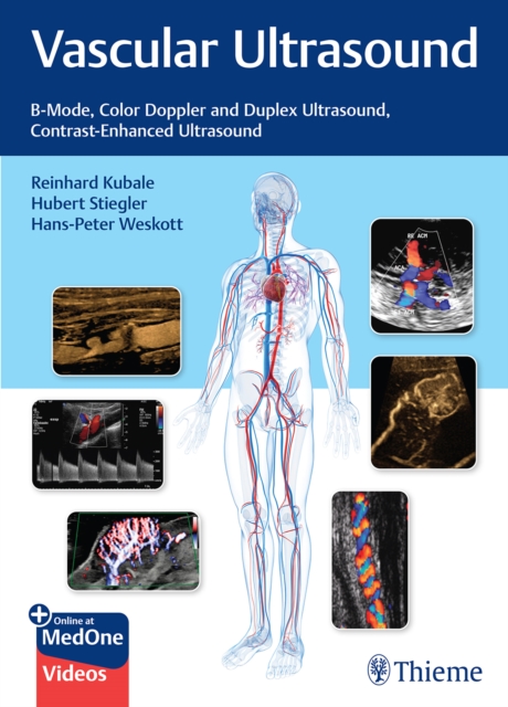 Vascular Ultrasound : B-Mode, Color Doppler and Duplex Ultrasound, Contrast-Enhanced Ultrasound, Multiple-component retail product, part(s) enclose Book