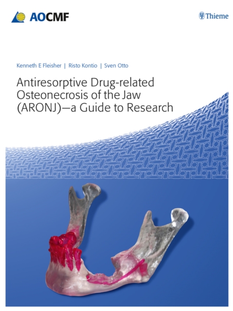 Antiresorptive Drug-Related Osteonecrosis of the Jaw (ARONJ) - A Guide to Research, EPUB eBook