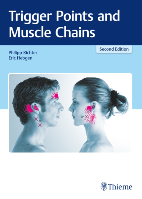 Trigger Points and Muscle Chains, EPUB eBook