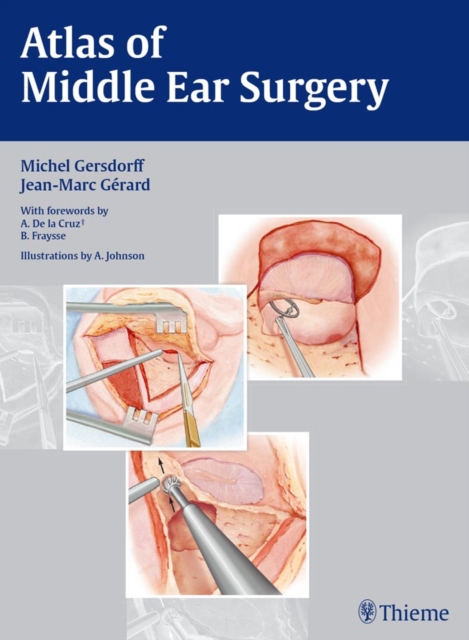 Atlas of Middle Ear Surgery, EPUB eBook