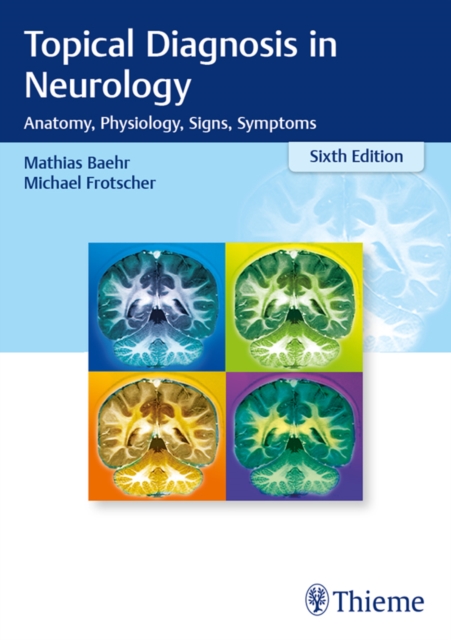 Topical Diagnosis in Neurology : Anatomy, Physiology, Signs, Symptoms, EPUB eBook