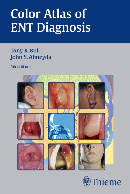 Color Atlas of ENT Diagnosis, EPUB eBook