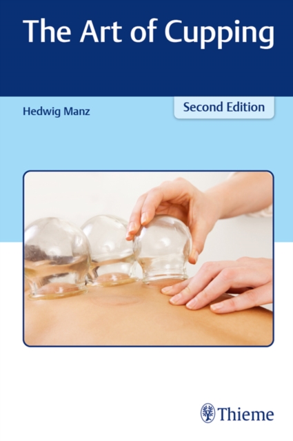 The Art of Cupping, EPUB eBook