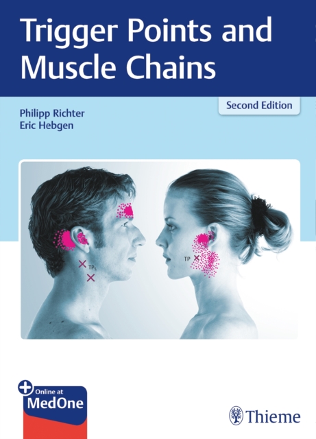 Trigger Points and Muscle Chains, EPUB eBook