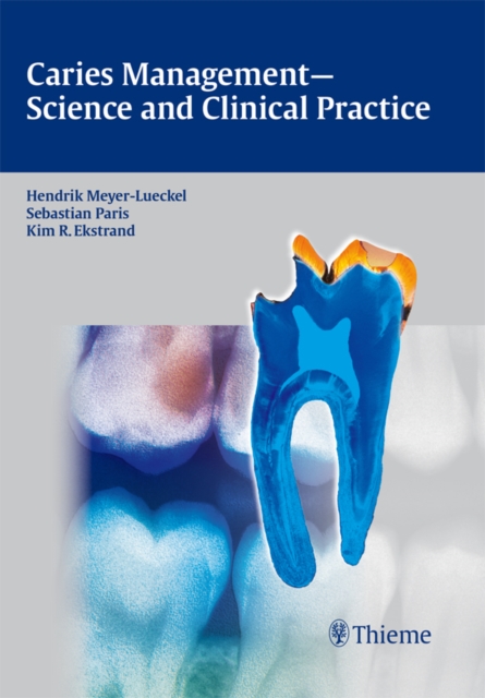 Caries Management - Science and Clinical Practice, EPUB eBook