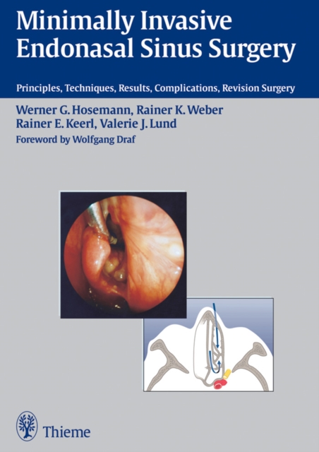 Minimally Invasive Endonasal Sinus Surgery : Principles, Techniques, Results, Complications, Revision Surgery, EPUB eBook