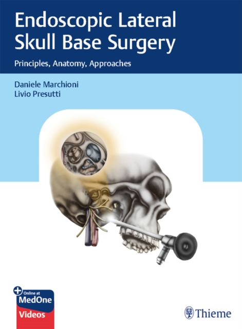 Endoscopic Lateral Skull Base Surgery : Principles, Anatomy, Approaches, EPUB eBook