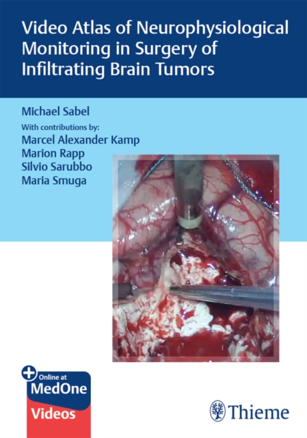 Video Atlas of Neurophysiological Monitoring in Surgery of Infiltrating Brain Tumors, EPUB eBook