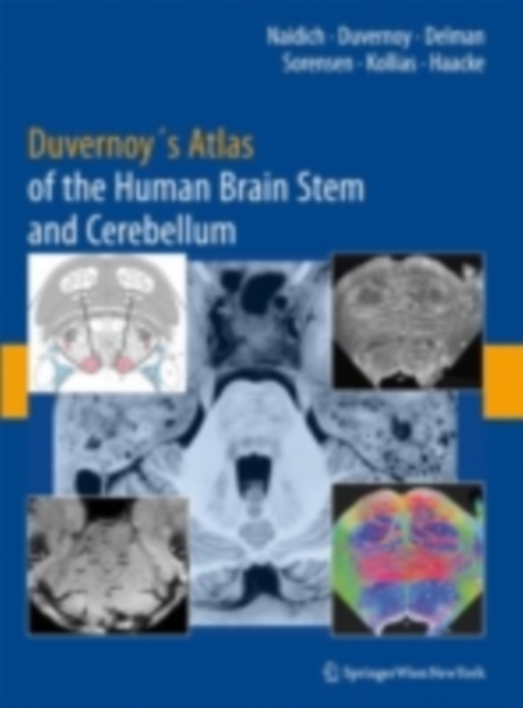 Duvernoy's Atlas of the Human Brain Stem and Cerebellum : High-Field MRI, Surface Anatomy, Internal Structure, Vascularization and 3 D Sectional Anatomy, PDF eBook