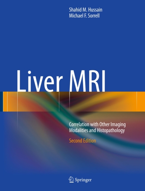 Liver MRI : Correlation with Other Imaging Modalities and Histopathology, PDF eBook