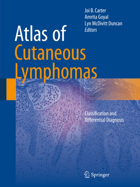 Atlas of Cutaneous Lymphomas : Classification and Differential Diagnosis, PDF eBook