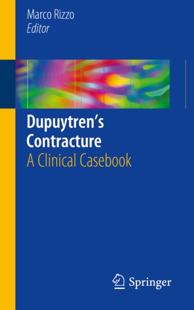 Dupuytren's Contracture : A Clinical Casebook, PDF eBook