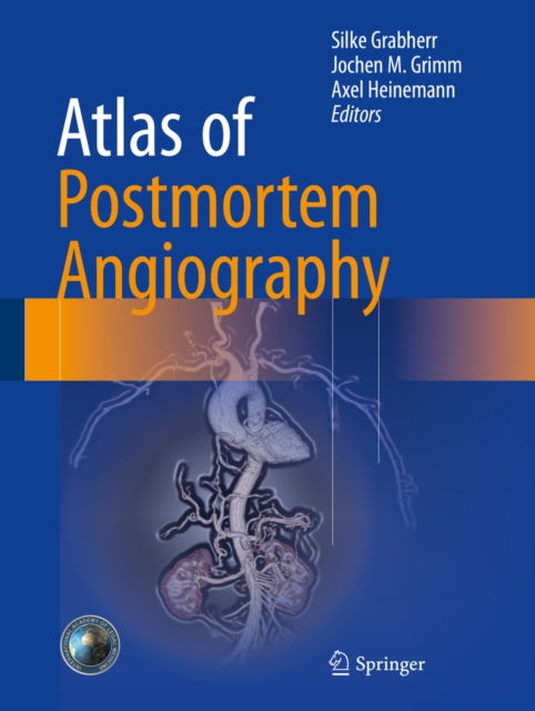 Atlas of Postmortem Angiography, PDF eBook