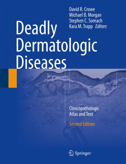 Deadly Dermatologic Diseases : Clinicopathologic Atlas and Text, PDF eBook