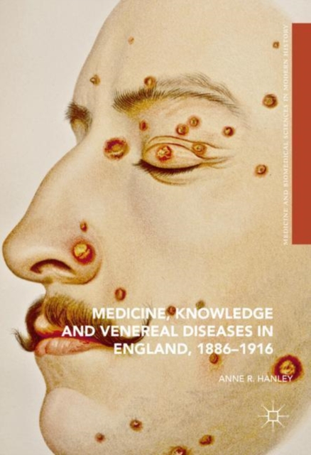 Medicine, Knowledge and Venereal Diseases in England, 1886-1916, EPUB eBook