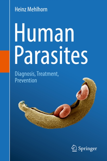 Human Parasites : Diagnosis, Treatment, Prevention, PDF eBook