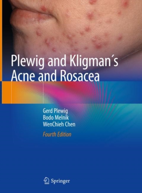 Plewig and Kligman's Acne and Rosacea, EPUB eBook