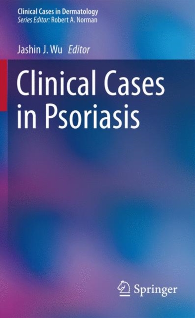 Clinical Cases in Psoriasis, EPUB eBook